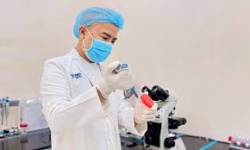 Tuổi nào tinh trùng bắt đầu suy giảm?