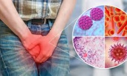 Thanh niên 22 tuổi mắc cùng lúc 4 loại vi khuẩn lây qua đường tình dục